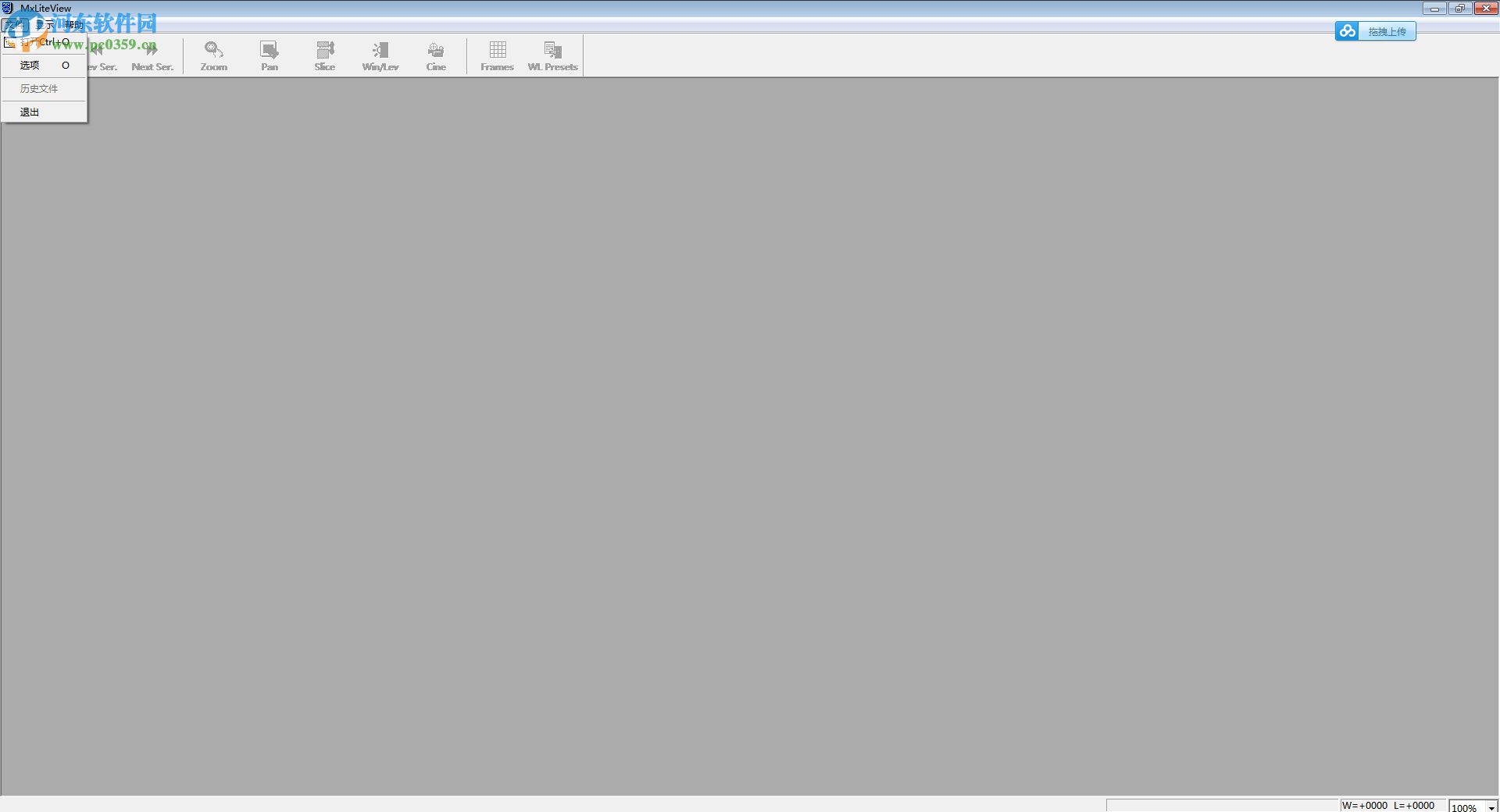 dicom图像浏览器(Philips DICOM Viewer) 1.3 中文绿色版