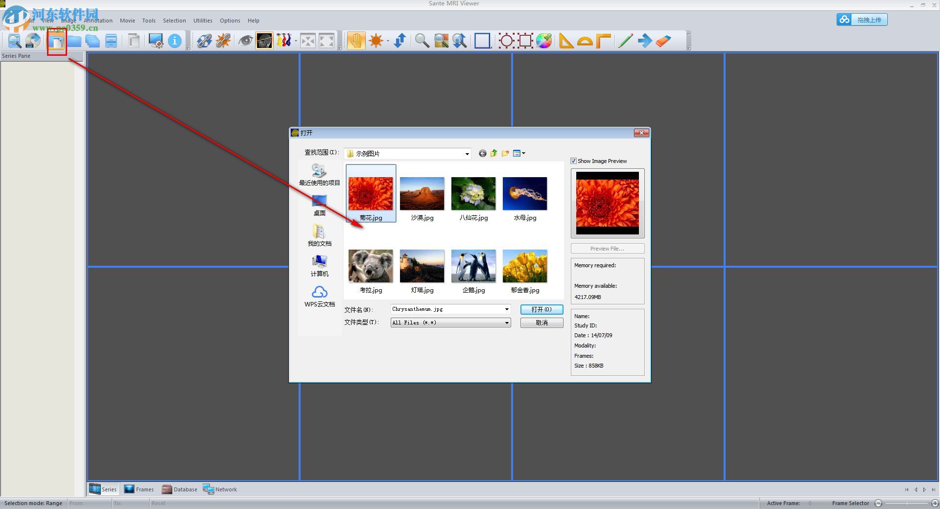 Sante CT Viewer(CT查看软件) 2.2 官方版