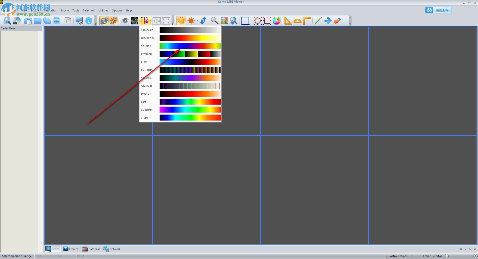 Sante CT Viewer(CT查看软件) 2.2 官方版