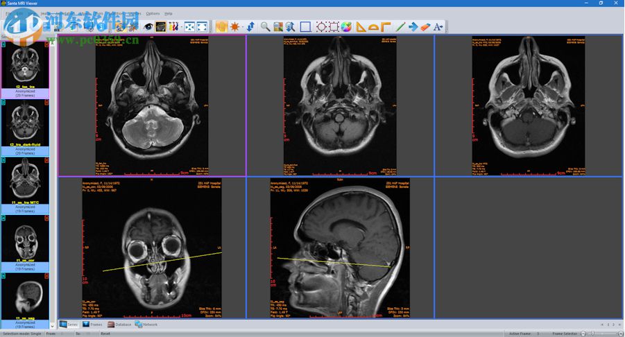Sante CT Viewer(CT查看软件) 2.2 官方版