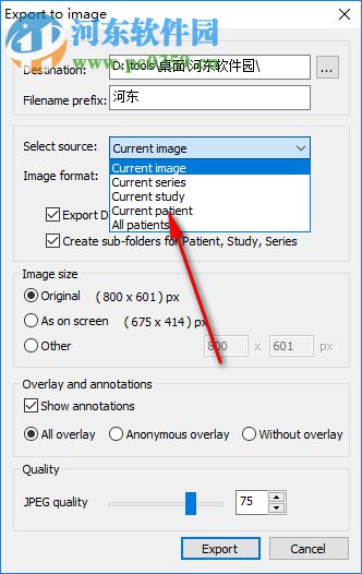 MicroDicom viewer(Dicom格式看图软件) 2.9.2 官方版