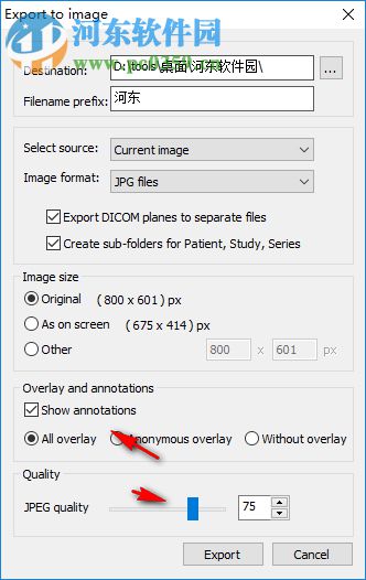 MicroDicom viewer(Dicom格式看图软件) 2.9.2 官方版