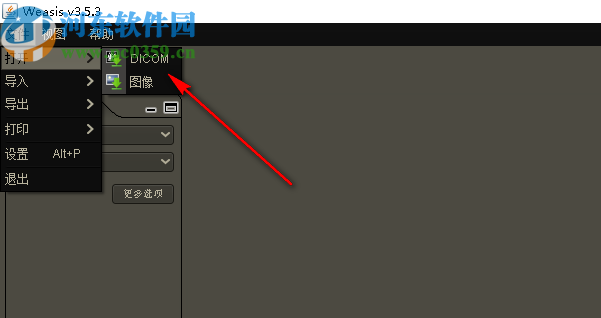 Weasis下载(DICOM看图软件)